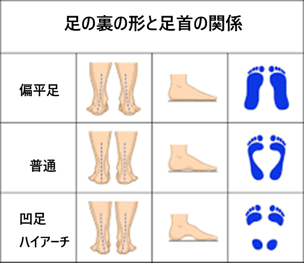 足の裏の種類